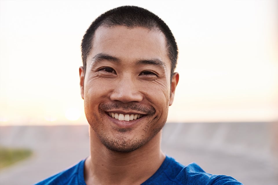 Minimal Veneers in Schaumburg, IL